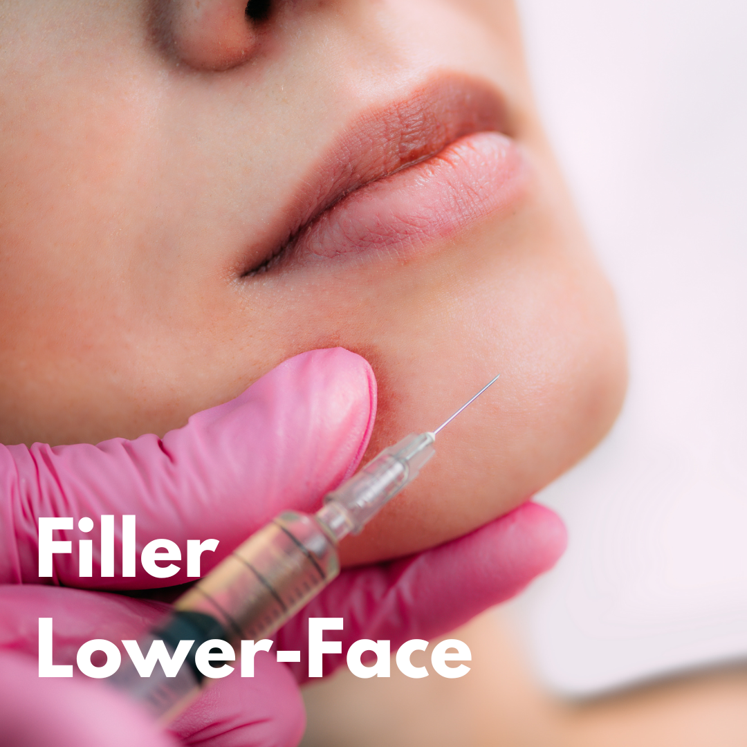 Filler Lower Face