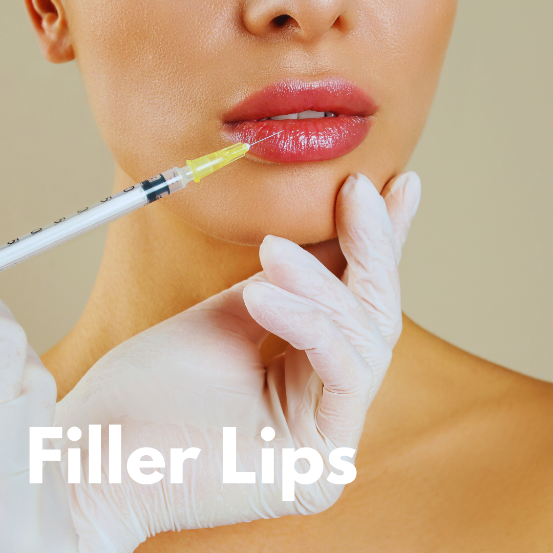 Filler Lips