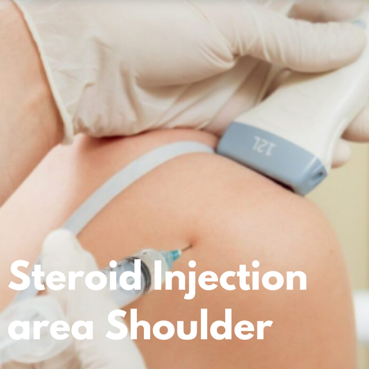 Steroid Injection area shoulder