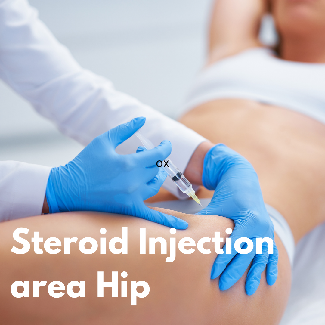 Steroid Injection Area Hip