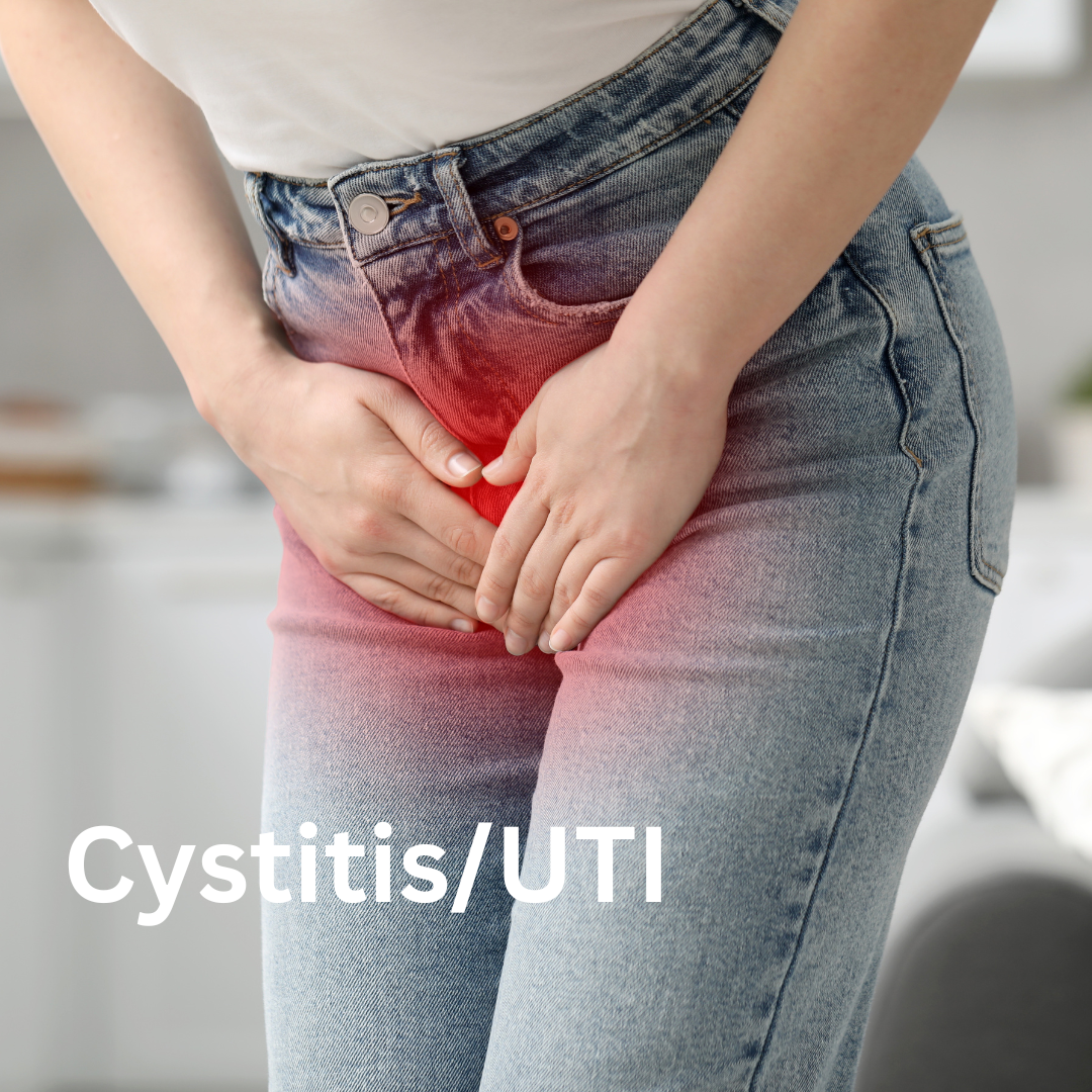 Cystitis/ UTI