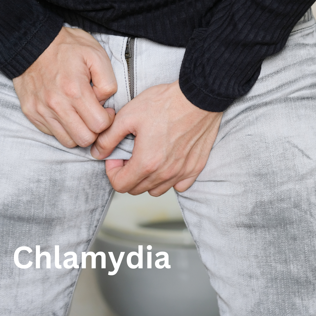 Chlamydia