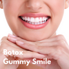 Botox Gummy Smile